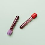 blood samples